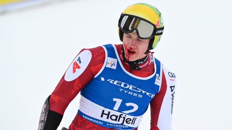 After crashing into the gate at the world cup, cbcaustria's