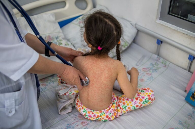 The european region reports the most measles cases in over